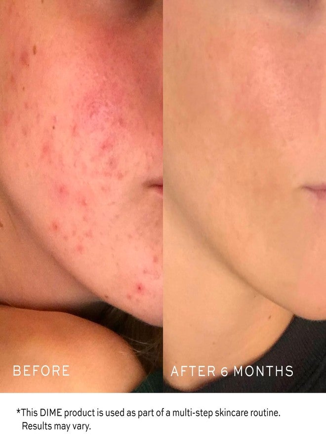 DIME Beauty Gentle Jelly Cleanser, Hydrating Facial Cleanser and Makeup Remover with Vitamin E, Sensitive Skin Face Wash, 4 oz / 120 ml - Image 4